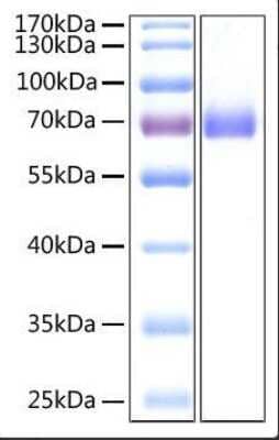 SDS-PAGE: Recombinant SARS-CoV-2 Spike S2 (ECD) His (C-Term) Protein [NBP2-92990]