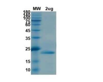 SDS-PAGE: Recombinant SARS-CoV-2 nsp1 His (N-Term) Protein [NBP3-07952]