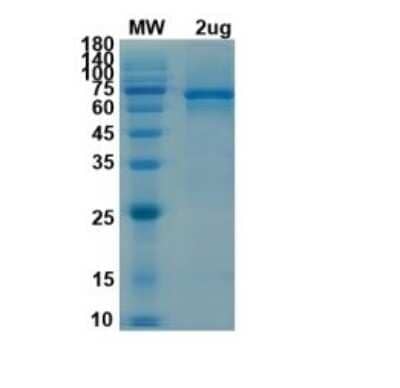 SDS-PAGE: Recombinant SARS-CoV-2 nsp13 His (N-Term) Protein [NBP3-07081]