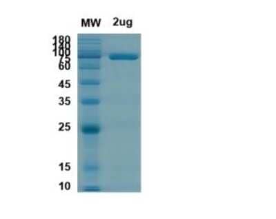SDS-PAGE: Recombinant SARS-CoV-2 nsp2 His (N-Term) Protein [NBP3-07083]
