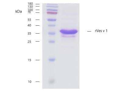 SDS-PAGE: Recombinant Vespula vulgaris 1.0101 Strep (N-Term) Protein [NBP3-07019]