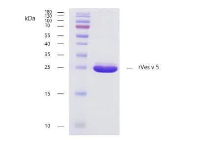 SDS-PAGE: Recombinant Vespula vulgaris 5.0101 Strep (N-Term) Protein [NBP3-07020]
