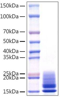 SDS-PAGE: Recombinant Viral Monkeypox Virus A29L (HEK-293-expressed) His (C-Term) Protein [NBP3-18267]