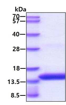 SDS-PAGE: Recombinant Dengue Virus 2 His Protein [NBP2-51767]