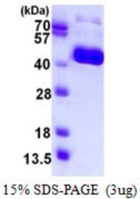 SDS-PAGE: Recombinant Influenza A H1N1 Hemagglutinin (A/New York/3571/2009) His Protein [NBP1-99041]