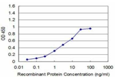 ELISA: Recoverin Antibody (1D3) [H00005957-M03]