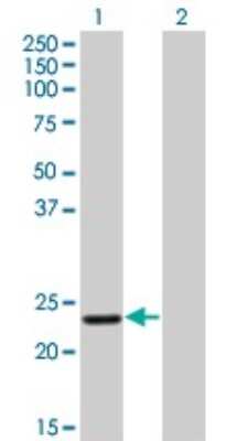 Western Blot: Recoverin Antibody (1D3) [H00005957-M03]