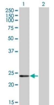 Western Blot: Recoverin Antibody (2H4) [H00005957-M05]