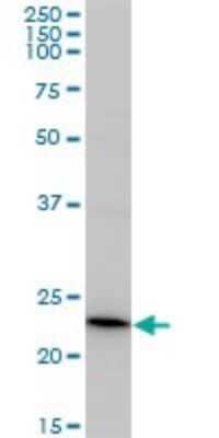 Western Blot: Recoverin Antibody (3F6) [H00005957-M37]