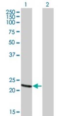 Western Blot: Recoverin Antibody (4C6) [H00005957-M01]