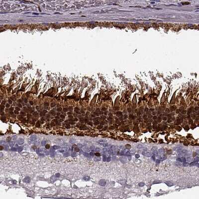 Immunohistochemistry-Paraffin: Recoverin Antibody [NBP2-58802]