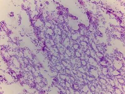 Hematoxylin & Eosin Stain: Rectum Tissue Slides (Adult Normal)- Frozen [NBP2-77556]