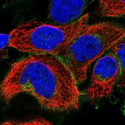 Immunocytochemistry/ Immunofluorescence: Reduced Folate Carrier/SLC19A1 Antibody [NBP1-83430]