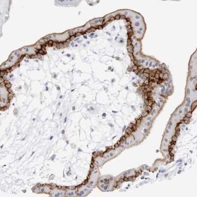 Immunohistochemistry-Paraffin: Reduced Folate Carrier/SLC19A1 Antibody [NBP1-83430]