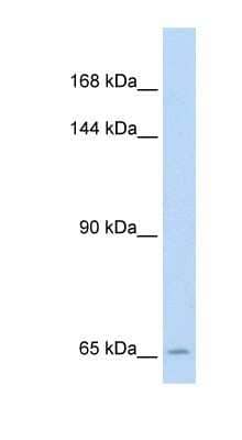 Western Blot: Reduced Folate Carrier/SLC19A1 Antibody [NBP1-59904]