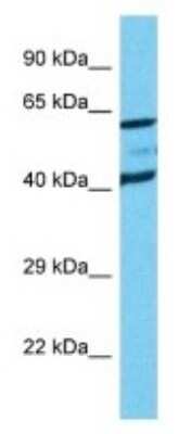 Western Blot: Reduced Folate Carrier/SLC19A1 Antibody [NBP3-09929]