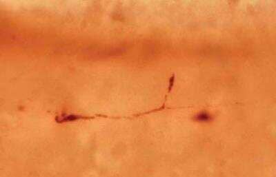 Immunohistochemistry: Reelin Antibody (142) - BSA Free [NB600-1080]