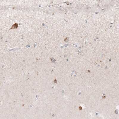 Immunohistochemistry-Paraffin: Reelin Antibody (CL5324) [NBP2-61414]