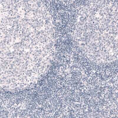 Immunohistochemistry-Paraffin: Reelin Antibody (CL5324) [NBP2-61414]