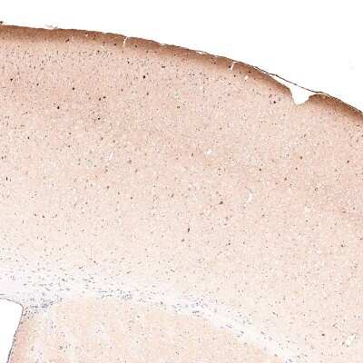 Immunohistochemistry-Paraffin: Reelin Antibody (CL5324) [NBP2-61414]