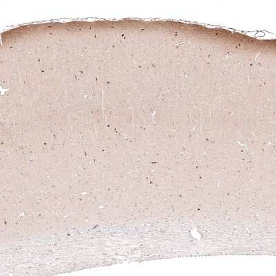 Immunohistochemistry-Paraffin: Reelin Antibody (CL5324) [NBP2-61414]