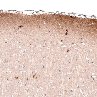 Immunohistochemistry-Paraffin: Reelin Antibody (CL5324) [NBP2-61414]