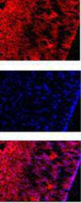 Immunohistochemistry: Reelin Antibody (G10) - BSA Free [NB600-1081]
