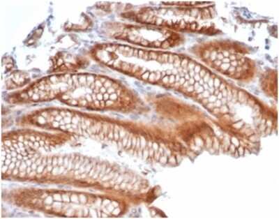 Immunohistochemistry-Paraffin: Reelin Antibody (RELN/4498) [NBP3-13874]