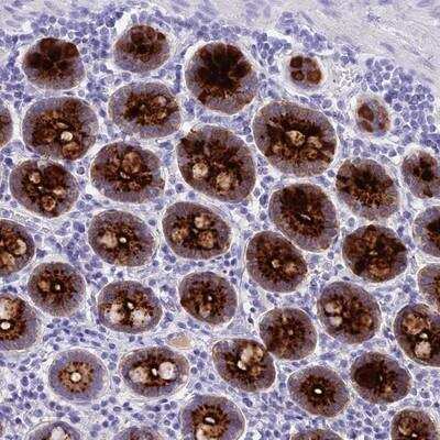 Immunohistochemistry-Paraffin: Reg1A Antibody [NBP2-13216]