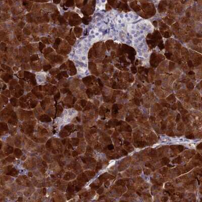 Immunohistochemistry-Paraffin: Reg1A Antibody [NBP2-13216]