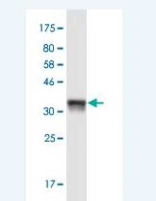 Western Blot: Reg1A Antibody (5F8) [H00005967-M17-100ug]