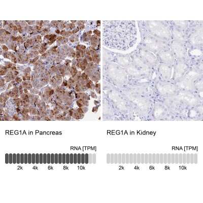 Immunohistochemistry-Paraffin: Reg1A Antibody [NBP2-13215]