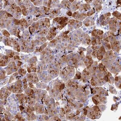 Immunohistochemistry-Paraffin: Reg1A Antibody [NBP2-13215]