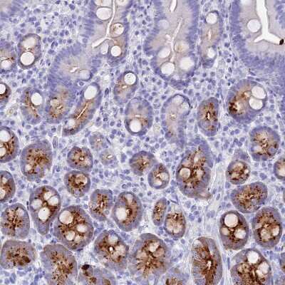 Immunohistochemistry-Paraffin: Reg1A Antibody [NBP2-13215]