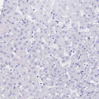 Immunohistochemistry-Paraffin: Reg1A Antibody [NBP2-13215]