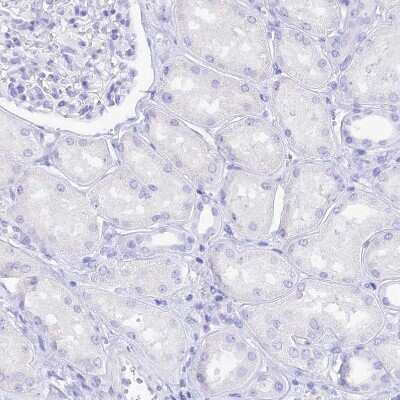 Immunohistochemistry-Paraffin: Reg1A Antibody [NBP2-13215]