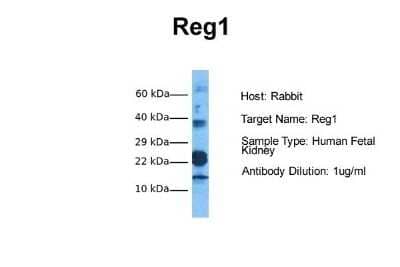 Western Blot: Reg1A Antibody [NBP1-98445]