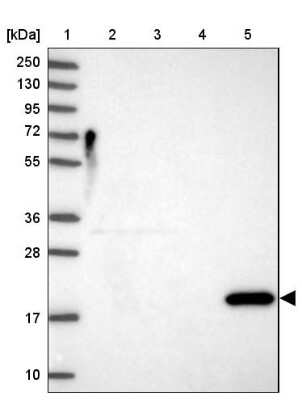 Western Blot: Reg1A Antibody [NBP2-13215]
