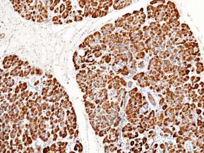Immunohistochemistry-Paraffin: Reg1B Antibody [NBP2-99850]