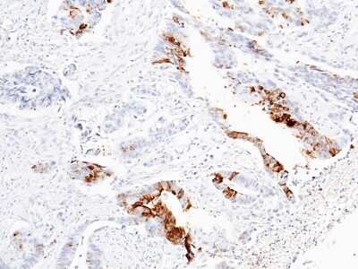 Immunohistochemistry-Paraffin: Reg1B Antibody [NBP2-99850]