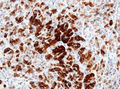 Immunohistochemistry-Paraffin: Reg3A Antibody (019) [NBP2-89856]