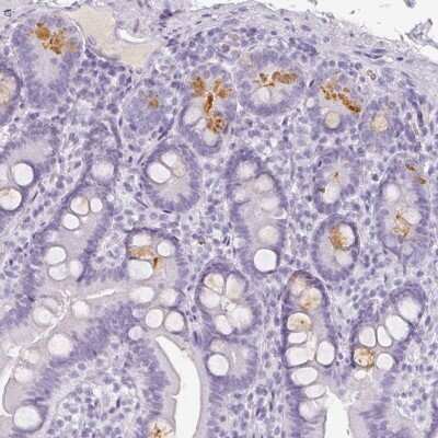 Immunohistochemistry-Paraffin: Reg3A Antibody [NBP2-56947]