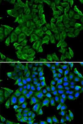 Immunocytochemistry/ Immunofluorescence: Reg3G Antibody - BSA Free [NBP2-93737]