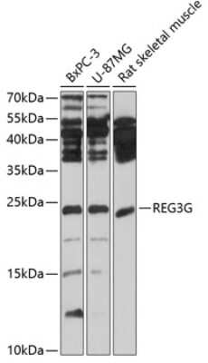 Western Blot: Reg3G AntibodyBSA Free [NBP2-93737]