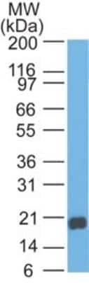 Western Blot: Reg3A Antibody [NBP2-24763]