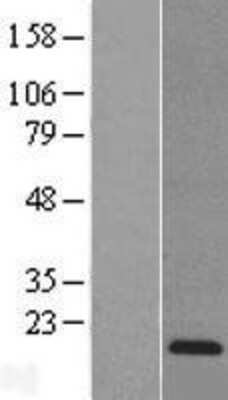 Western Blot: Reg3A Overexpression Lysate [NBL1-15274]