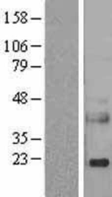 Western Blot: Reg3A Overexpression Lysate [NBP2-05623]