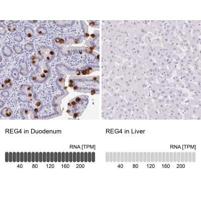 Immunohistochemistry-Paraffin: Reg4 Antibody [NBP2-38552]