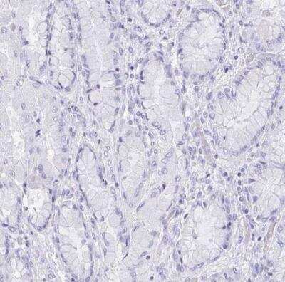 Immunohistochemistry-Paraffin: Reg4 Antibody [NBP2-38552]