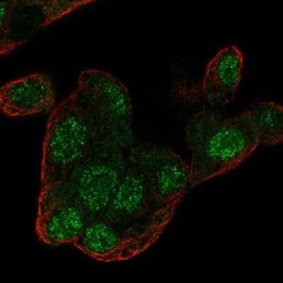 Immunocytochemistry/ Immunofluorescence: Regucalcin Antibody [NBP1-80850]